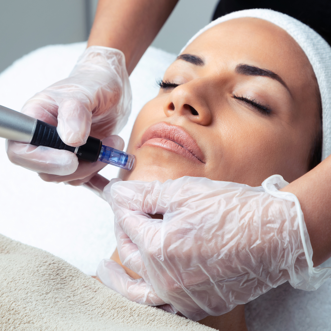 MICRONEEDLING AND NEEDLE FREE MICRONEEDLING - gbeautybar